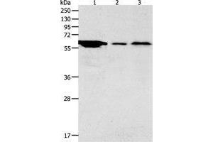 Western Blotting (WB) image for anti-Adenylate Cyclase Activating Polypeptide 1 (Pituitary) Receptor Type I (ADCYAP1R1) antibody (ABIN1870813) (ADCYAP1R1 anticorps)