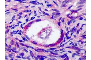 Human Ovary: Formalin-Fixed, Paraffin-Embedded (FFPE)