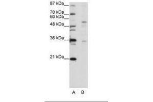 Image no. 1 for anti-Zinc Finger Protein 57 (ZFP57) (C-Term) antibody (ABIN202756) (ZFP57 anticorps  (C-Term))