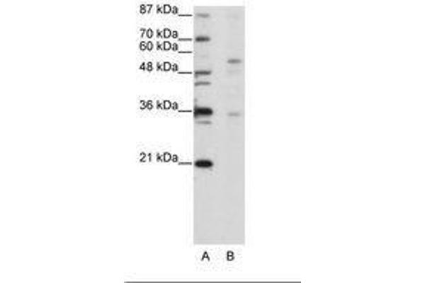 ZFP57 anticorps  (C-Term)