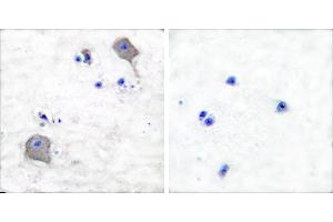 Peptide - +Immunohistochemical analysis of paraffin-embedded human brain tissue using Claudin 5 antibody (#C0145). (Claudin 5 anticorps)