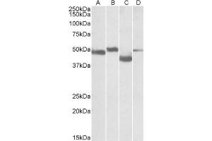 Staining of Mouse Brain (lane A), Rat Brain (lane B), Mouse Thymus (lane C) and Rat Thymus (lane D) lysates  using MEIS2 antibody at 0. (MEIS2 anticorps  (Internal Region))