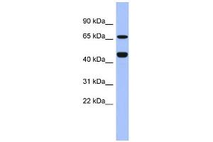 WB Suggested Anti-ZNF713 Antibody Titration:  0. (ZNF713 anticorps  (Middle Region))