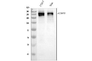 Western blot analysis of CHD2 using anti-CHD2 antibody (ABIN7602759).
