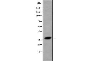 Western blot analysis of HOXB8 using LOVO whole cell lysates (HOXB8 anticorps  (Internal Region))