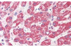 Detection of HAO1 in Human Liver Tissue using Polyclonal Antibody to Hydroxyacid Oxidase 1 (HAO1)