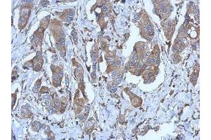 Image no. 1 for anti-Purinergic Receptor P2X, Ligand Gated Ion Channel 2 (P2RX2) (AA 8-302) antibody (ABIN1499950)