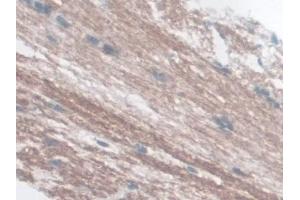 anti-Glucagon-Like Peptide 1 Receptor (GLP1R) (AA 25-145) antibody