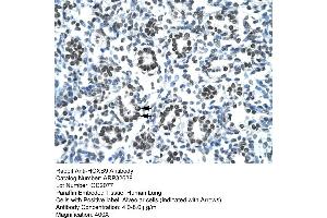 Human Lung (HOXB9 anticorps  (N-Term))
