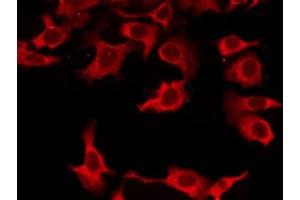 ABIN6276272 staining LOVO by IF/ICC.