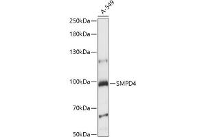 Western blot analysis of extracts of A-549 cells, using SMPD4 antibody (ABIN7270531) at 1:1000 dilution. (SMPD4 anticorps  (AA 600-800))