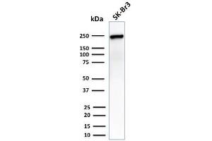 Western Blot Analysis of SK-Br3 cell lysate using CHD4 Mouse Monoclonal Antibody (3F2/4). (CHD4 anticorps  (C-Term))