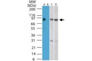 Western blot analysis of SKIL in human kidney lysate in the A) absence and B) presence of immunizing peptide, C) mouse kidney, and D) rat kidney lysate. (SKIL anticorps  (AA 600-684))