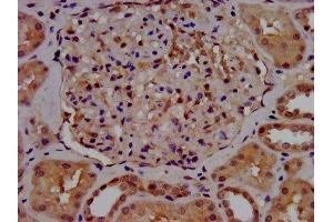 IHC image of ABIN7155172 diluted at 1:500 and staining in paraffin-embedded human kidney tissue performed on a Leica BondTM system.