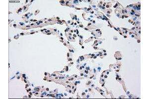 Image no. 7 for anti-Polo-Like Kinase 1 (PLK1) antibody (ABIN1500281)