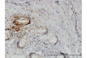 Image no. 1 for anti-Twinfilin, Actin-Binding Protein 1 (TWF1) (AA 80-252) antibody (ABIN465966)