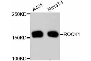 Western blot analysis of extracts of various cell lines, using ROCK1 antibody (ABIN5997107). (ROCK1 anticorps)
