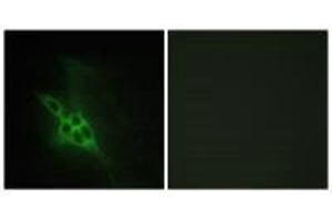 Immunofluorescence analysis of NIH/3T3 cells, using EPHB1/2/3 antibody. (EPHB1/EPHB2/EPHB3 anticorps)