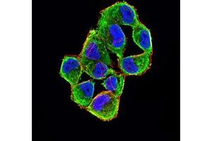 Immunofluorescence analysis of Hela cells using CDKN2A/P16 mouse mAb (green). (Tumor Suppressor ARF (CDKN2A) (AA 1-156) anticorps)