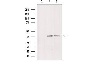 Western blot analysis of extracts from various samples, using BNIP2 Antibody. (BNIP2 anticorps  (Internal Region))