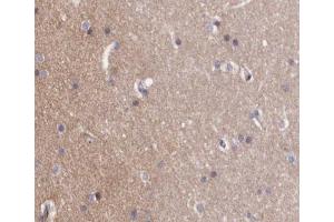 ABIN6267257 at 1/200 staining human brain tissue sections by IHC-P. (ABL1 anticorps  (pTyr412))