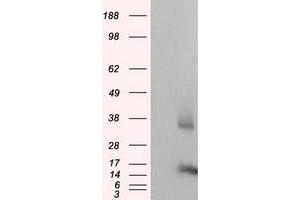 Western Blotting (WB) image for anti-CDGSH Iron Sulfur Domain 1 (CISD1) antibody (ABIN1497521) (CISD1 anticorps)