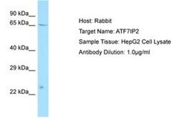 ATF7IP2 anticorps  (AA 100-149)