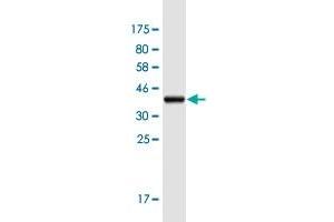 Western Blot detection against Immunogen (37.