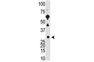 Image no. 1 for anti-Recoverin (RCVRN) (C-Term) antibody (ABIN357114)