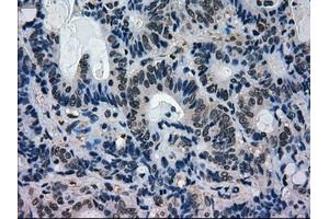 Image no. 3 for anti-Mitogen-Activated Protein Kinase 1 (MAPK1) antibody (ABIN1499293)