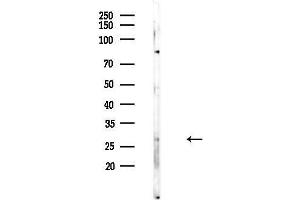 anti-Empty Spiracles Homeobox 2 (EMX2) (N-Term) antibody