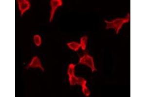 ABIN6267645 staining HeLa by IF/ICC.