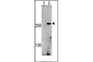 Western blot analysis of PIP5K3 (arrow) using rabbit polyclonal PIP5K3 Antibody