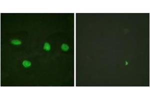 Immunofluorescence analysis of HeLa cells, using 53BP1 (Ab-6) Antibody. (TP53BP1 anticorps  (AA 1-50))