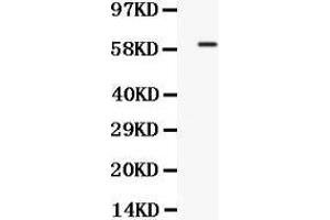 anti-Transcription Factor 7-Like 1 (T-Cell Specific, HMG-Box) (TCF7L1) (AA 561-588), (C-Term) antibody