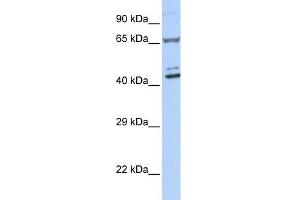 WB Suggested Anti-ZNF324 Antibody Titration:  0. (ZNF324 anticorps  (Middle Region))