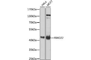 Western blot analysis of extracts of various cell lines, using FBXO22 antibody (ABIN6131311, ABIN6140516, ABIN6140517 and ABIN6224399) at 1:1000 dilution.