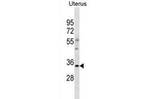 OR6S1 Antibody (C-term) (ABIN1881609 and ABIN2838743) western blot analysis in human Uterus tissue lysates (35 μg/lane).