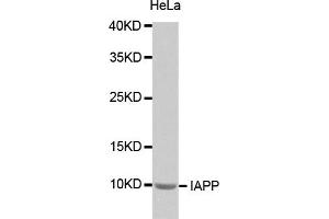 Western blot analysis of extracts of HeLa cells, using IAPP antibody (ABIN2974276). (Amylin/DAP anticorps)