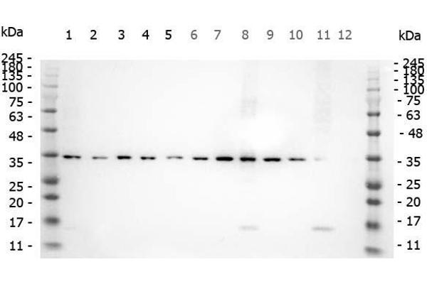 SMAD3 抗体  (pSer423, pSer425)