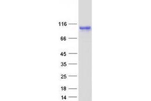 Validation with Western Blot