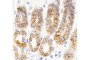 Immunohistochemistry (IHC) image for anti-C2 Calcium Dependent Domain Containing 5 (C2CD5) (AA 375-425) antibody (ABIN7454753) (C2CD5/KIAA0528 anticorps  (AA 375-425))