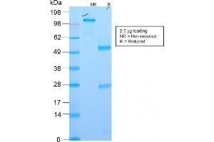 SDS-PAGE Analysis Purified EpCAM Rabbit Recombinant Monoclonal Antibody (EGP40/2571R). (Recombinant EpCAM anticorps  (Extracellular Domain))