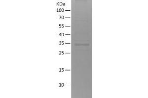 Western Blotting (WB) image for BCL2-Associated X Protein (BAX) (AA 1-110) protein (His-IF2DI Tag) (ABIN7121982)
