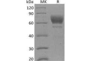 Tyrosine protein (His tag)