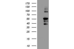 Western Blotting (WB) image for anti-Protein Phosphatase 1, Regulatory (Inhibitor) Subunit 15A (PPP1R15A) antibody (ABIN1498364) (GADD34 anticorps)