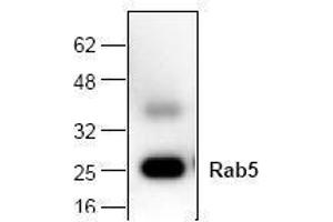 Image no. 1 for anti-RAB5A, Member RAS Oncogene Family (RAB5A) antibody (ABIN127153) (RAB5 anticorps)