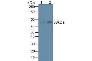 Western blot analysis of (1) Mouse Liver Tissue and (2) Mouse Lung Tissue. (ITGB1 anticorps  (AA 454-714))