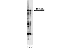 Western blot analysis for Tie2. (TEK anticorps  (Extracellular Domain))