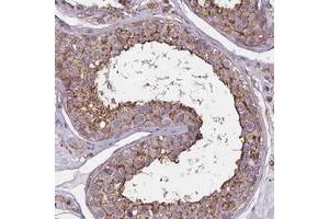 Immunohistochemical staining of human testis with FAM70B polyclonal antibody  shows moderate cytoplasmic and membranous positivity in cells of seminiferus ducts. (TMEM255B anticorps)